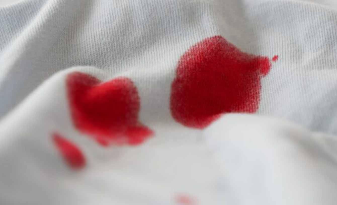 ¿Manchas de sangre en la ropa? Así puedes eliminarlas paso a paso con ayuda del vapor