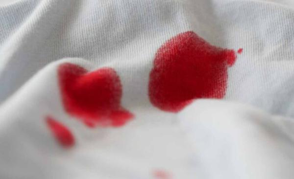 ¿Manchas de sangre en la ropa? Así puedes eliminarlas paso a paso con ayuda del vapor